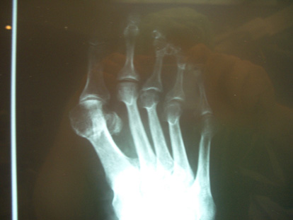 Radiografia pre operat�ria